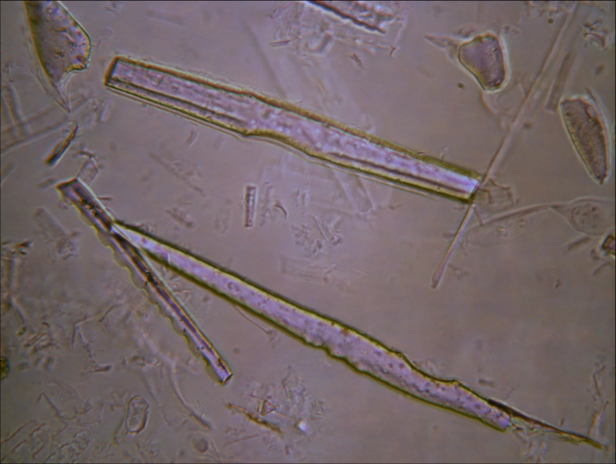 AGPA Pepperwood elongate phytolith micrograph