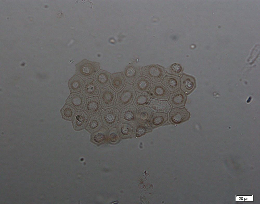 Phytolith micrograph