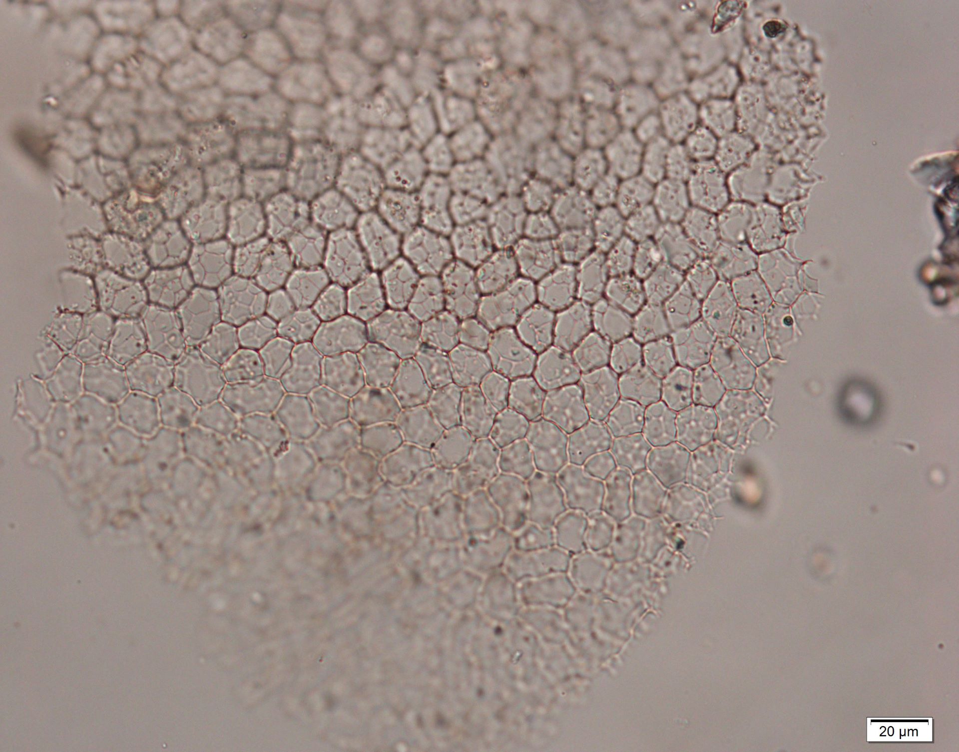 Phytolith micrograph