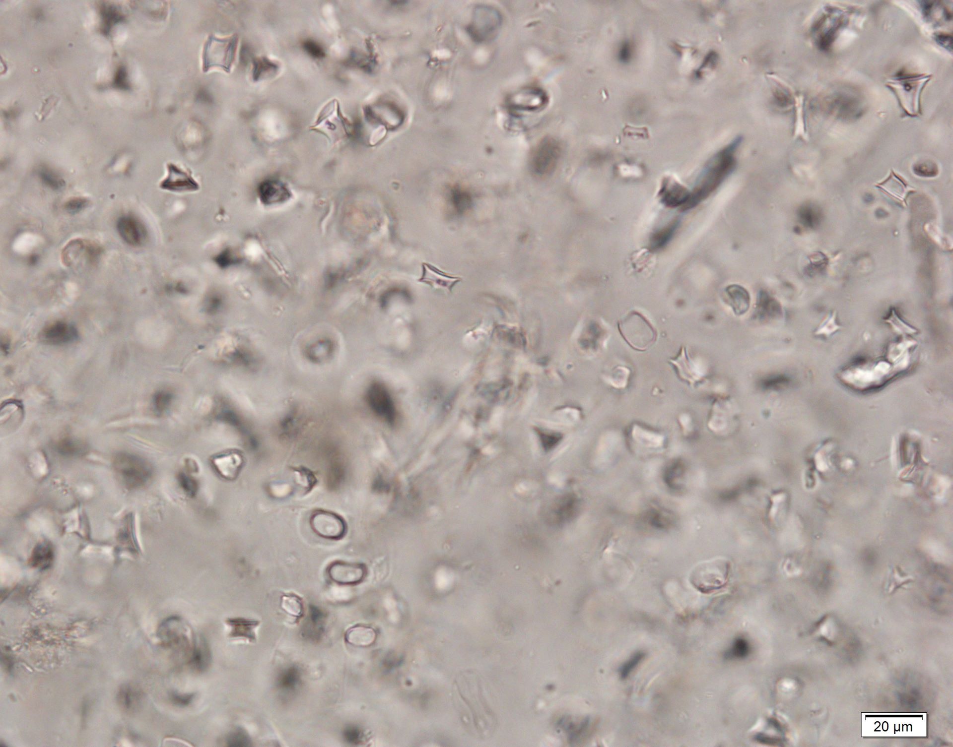 Phytolith micrograph