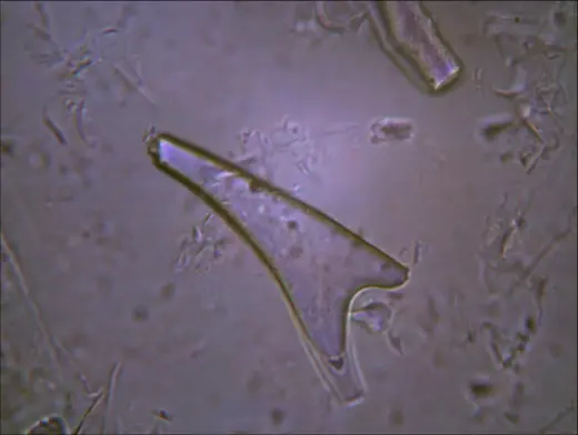 Agpa Pepperwood Thin Trichome4