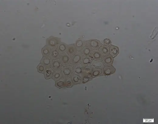 Phytolith2