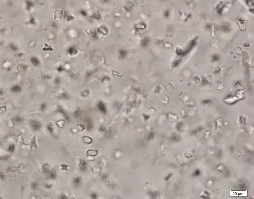 Phytolith6